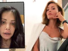 Didem Ceran’dan şoke eden paylaşım: Yüzü nakledilen kişinin alnı kaşıma denk geldi!