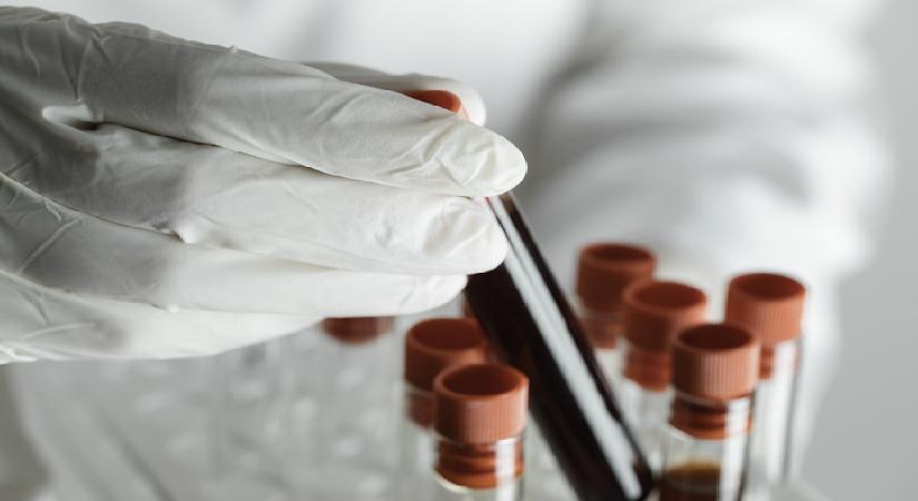‘Gençlik’ bu proteinlerde gizli olabilir… 100 yaşına ulaşmanın sırrı kanımızda mı?