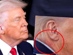 Trump’ın boynuna ne oldu? Kanser tedavisi mi görüyor?