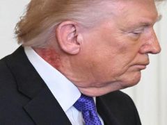 Trump’ın boynundaki kırmızı leke gündem oldu.