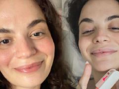 Aslı Bekiroğlu 7. sefer ameliyat oldu