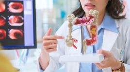 Bağırsak kanseri neden gençlerde artıyor? Uzman isim 4 büyük riski tek tek sıraladı