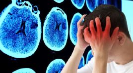 Baş ağrısı ve unutkanlığı hafife almayın! Altından bir tümör çıkabilir