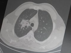 Elektronik sigara için “süre doldu”