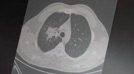 Elektronik sigara için “süre doldu”