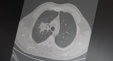 Elektronik sigara için “süre doldu”