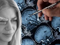 Görme sıkıntısını makyajdan sandı, gerçek çok ağır çıktı! 15 yıllık doğum denetim iğnesi sonrası tümör alarmı