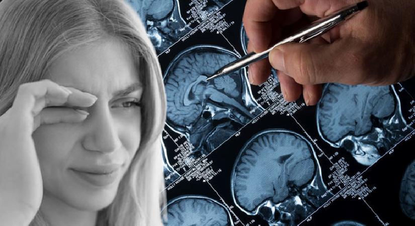 Görme sıkıntısını makyajdan sandı, gerçek çok ağır çıktı! 15 yıllık doğum denetim iğnesi sonrası tümör alarmı