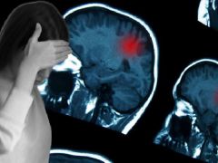 Migren dediler, birkaç hafta ömrü kaldığı ortaya çıktı! Genç kız artık ömür savaşı veriyor