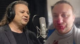 Ünlü sanatçı et yiyen bakteriyle savaşıyor