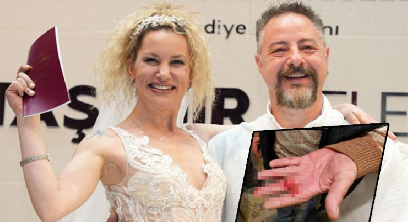 Yıldız Asyalı’nın büyük çaresizliği… ‘Babam da eşim tarafından darp edildi’