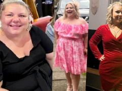 Zayıflama ameliyatı gerçeği: Tam 57 kilo verdi fakat yaşadıkları şaşırttı… ‘Kimse bu ayrıntıları anlatmıyor’