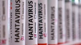 Hantavirüste hangi meslekler daha fazla risk altında?