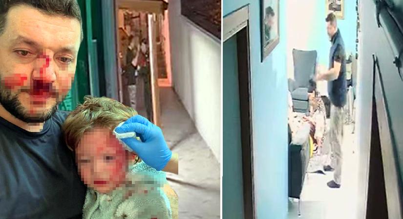 Baba ve 14 aylık kızına akın davası. Tutuklu sanık tahliye edildi