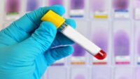 Alzheimer riskini öngören yeni bir kan testi yolda! Tam olarak ne vakit hazır olacak?