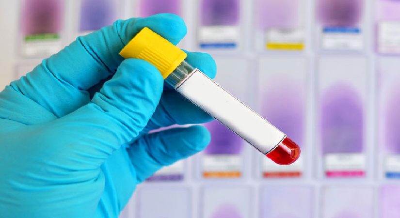 Alzheimer riskini öngören yeni bir kan testi yolda! Tam olarak ne vakit hazır olacak?