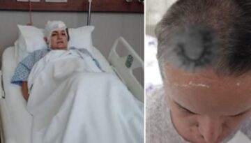 Diş ağrısı için gitti hayatı karardı. Şimdi beyninde ömür uzunluğu aygıtla yaşayacak