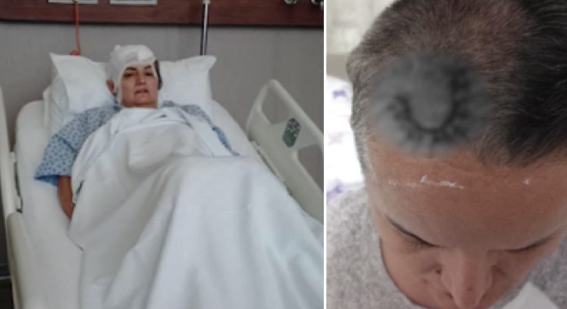 Diş ağrısı için gitti hayatı karardı. Şimdi beyninde ömür uzunluğu aygıtla yaşayacak