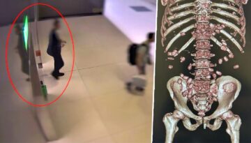 İstanbul Havalimanı’nda yürümekte zorlanan yolcu polisi alarma geçirdi. Gerçek hastanede ortaya çıktı