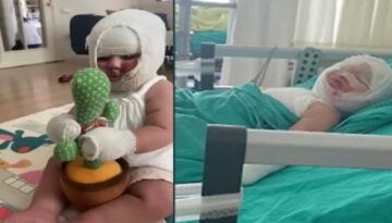 Domates konservesi bomba üzere patladı, 9 aylık bebeğin bedeni yandı