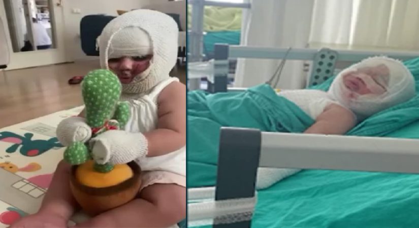 Domates konservesi bomba üzere patladı, 9 aylık bebeğin bedeni yandı