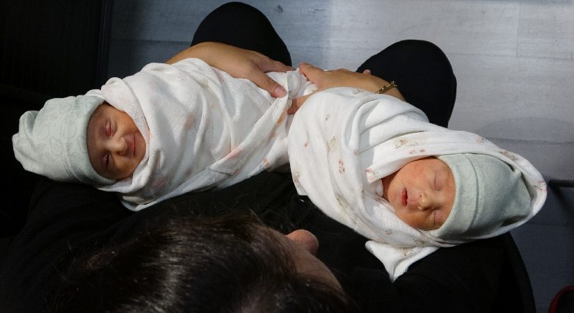 Dünyada üçüncü olay oldu. Trabzon’da milyonda bir görülen doğum