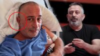 Kulak göğsündeki çizgi kalp krizi nedeni mi? Ünlü komedyende de varmış…