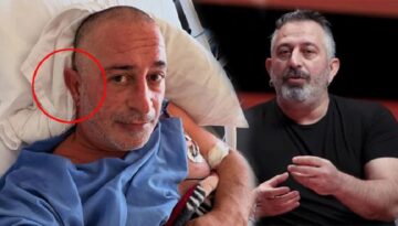 Kulak göğsündeki çizgi kalp krizi nedeni mi? Ünlü komedyende de varmış…