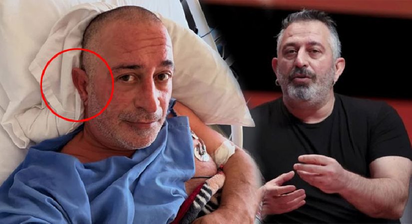 Kulak göğsündeki çizgi kalp krizi nedeni mi? Ünlü komedyende de varmış…
