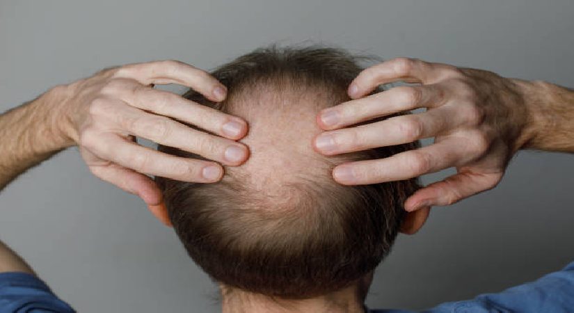 Obeziteye deva bulundu, sıra kellikte. İlaç devleri yarışa girdi