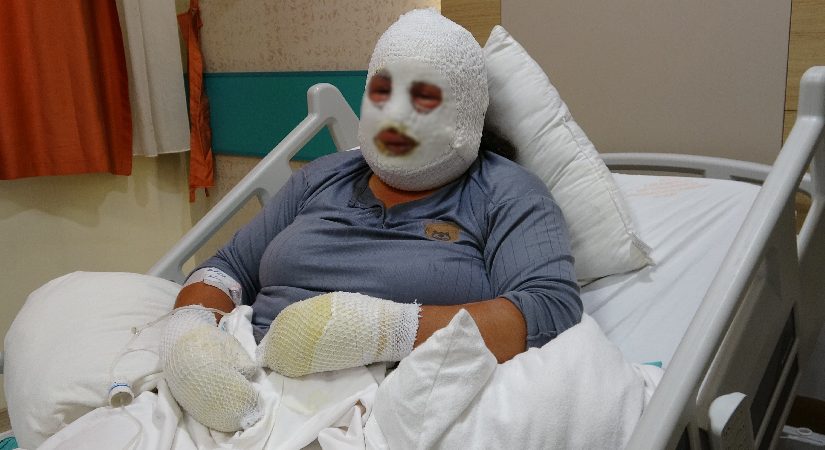 Ardahan’da yangın dehşeti: 6 yaşındaki kızını alevlerin arasından bu türlü kurtardı
