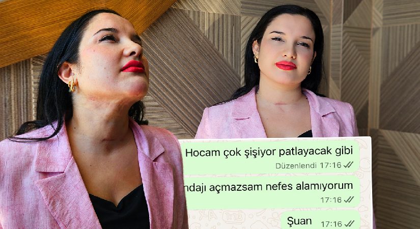 Estetik sonrası mevtten döndü, 5 milyon lira tazminat istedi. “Hocam patlayacak gibi”