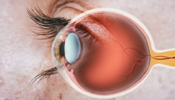 Tıp tarihinde bir ilk! Retinal nakil yapıldı, yıllar sonra tekrar görmeye başladı