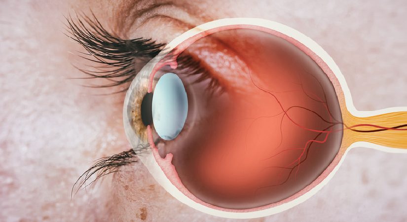 Tıp tarihinde bir ilk! Retinal nakil yapıldı, yıllar sonra tekrar görmeye başladı