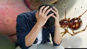 Küçük bir ısırıkla başladı, kabusa dönüştü! 48 saatte inanılmaz değişim