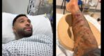 Liverpool’un eski yıldızı Jermaine Pennant’a köpek saldırdı! Bacağına 50 dikiş atıldı