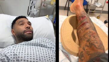 Liverpool’un eski yıldızı Jermaine Pennant’a köpek saldırdı! Bacağına 50 dikiş atıldı