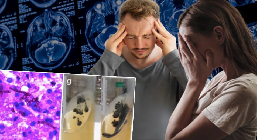 Olaylar süratle arttı: Ölümcül mantar tehlikesi! Tasa büyüyor, nasıl belirtiler veriyor?